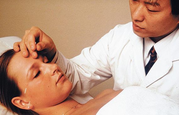 Akupunktur - Dr. med. Jian Ruan